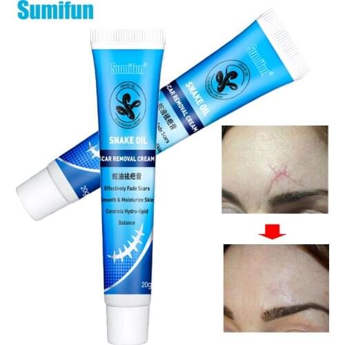 New Sumifun 1Pcs Snake Oil Ointment Remove Scar Cream Striae Gravidarum Pigmentation Acnecream Natural Chinese Plaster P1177
