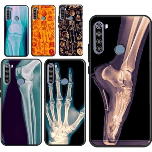 X-Ray Human Anatomy Case For Xiaomi Redmi Note 10 7 8 9 Pro Note 8T 9S Fundas For Redmi 9T 9C 9A 8A K40 Cover