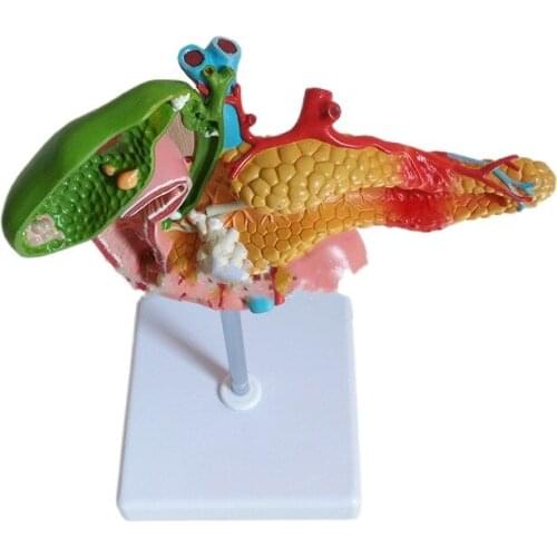 Pathological model of human duodenum, pancreas and gallbladder