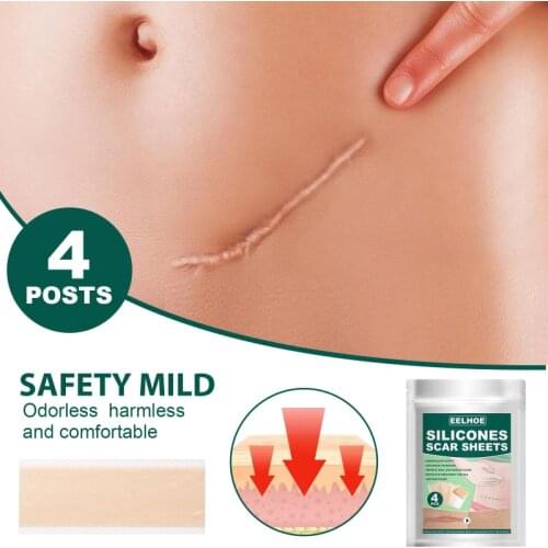4Pcs/Pack Scar Repair Stickers Stretch Marks Scald Scar Silicone Gel Strips Patch Scar Away Skin Repair Aliver Scar Patchs