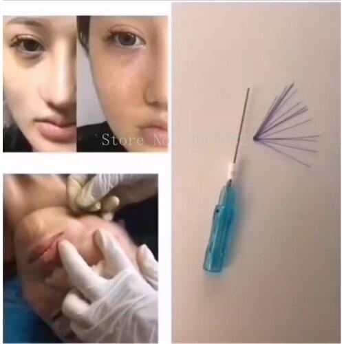 20 Thread Lifting Care Premium PDO Multi Fill 23G, L Type