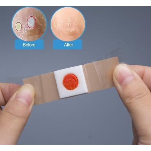 6pcs Foot Corns Removal Patch Warts Pain Relief Remover Foot Callus Medical Plaster Health Care D1609