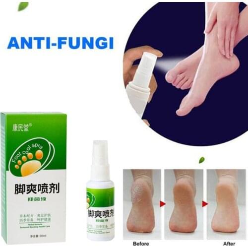 30ml Plant Spray Feet Care Remove Odor Sweat Feet Treatment Wholesale Natural Practical Foot Care Products
