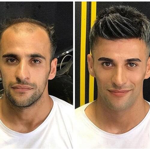 6 Inch Super Thin Skin Men Toupee Knot Hair Replacement Undetectable Front Hair Line Fast Shipping