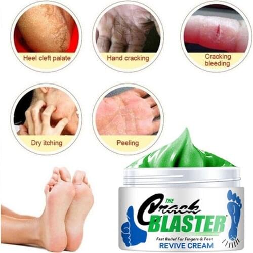 15g/30g/50g Cracked Hand And Foot Cream Foot Bubble And Car Anti-cracking Anti-dry And Peeling Hand And Feet Scar Rotten Fo Z0F6