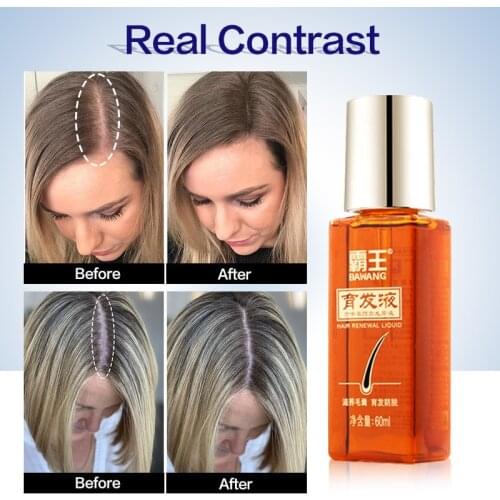 Hair Care Hair Growth Essential Oils Essence Anti Hair Loss Liquid Health Care Grow Repair Beauty Dense Fast Hair Growth Serum