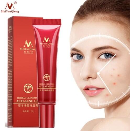 Herbal Remove Acne Repair Face Cream Moisturizing Nourishing Facial Gel Anti-acne Marks Lighten Tone Whitening Skin Care