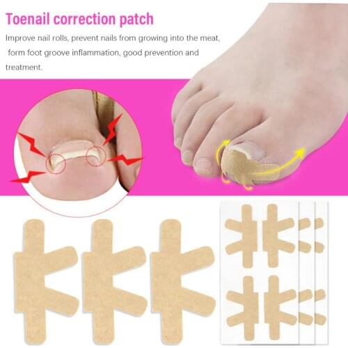 5 Sheet/Set Ingrown Toenail Corrector Stickers Orthodontic Paronychia Treatment Recover Patches Toe Fingernail Foot Care Tool