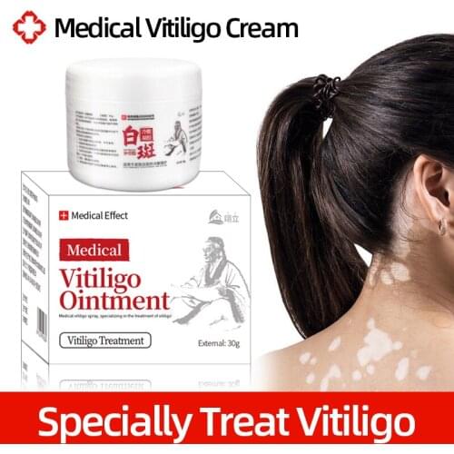 White Spot Antibacterial Cream Psoriasis Localized Vitiligo Ointment Leukoplakia Mycosis Treatment Care30g