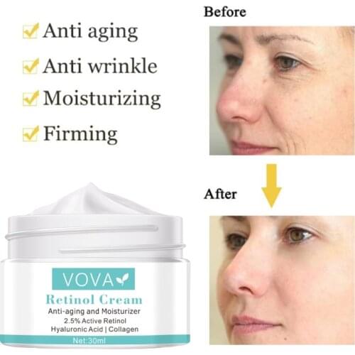 VOVA Retinol Face Cream Brighten Lifting Nourishing Skin Anti Aging Remove Wrinkles Moisturizing Serum Face Skin Care TSLM1