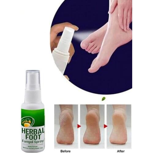 Foot Healing Natural Herbal Spray Shoe Deodorizing Spray Keep Your Feet Healthy Make Your Feet Skin Smoother Relax Your Body