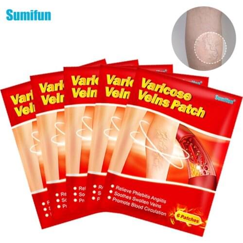Sumifun 6/18pcs Varicose Veins Plaster Vasculitis Phlebitis Spider Leg Skin Care Chinese Medical Patch Angiitis Removal Patch