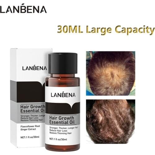 LANBENA 30ML Hair Growth Essence Large Capacity Anti Hair Loss Nourish Roots Ginger Extract Repair Hurt Hair Improve Growing