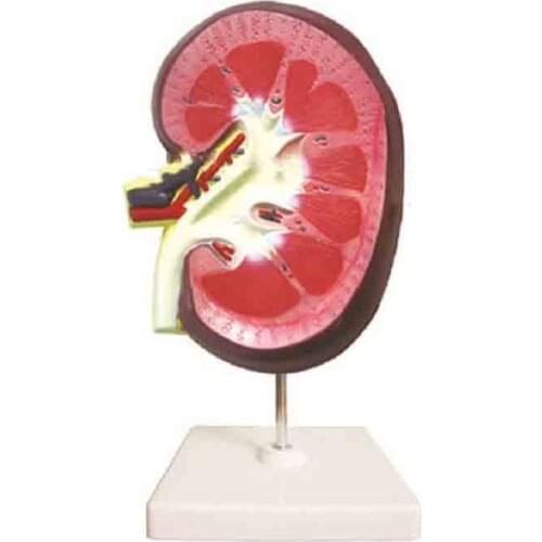 Anatomical model of kidney