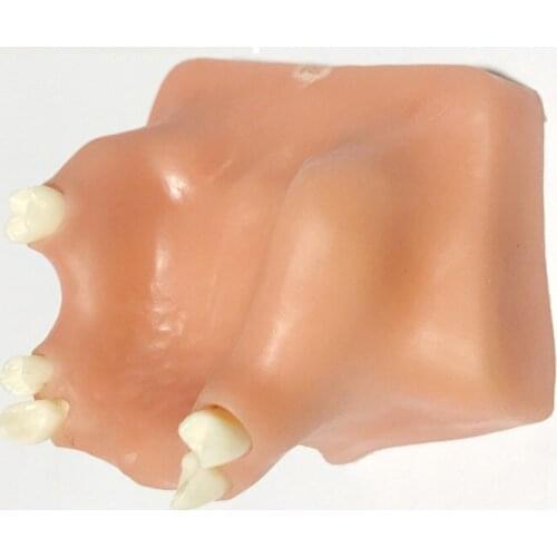 Oral Cavity Dental Implant Teaching Aids Bone Imitating Realistic Antrum Highborn Dental Implants Models Lifelike Teeth Model