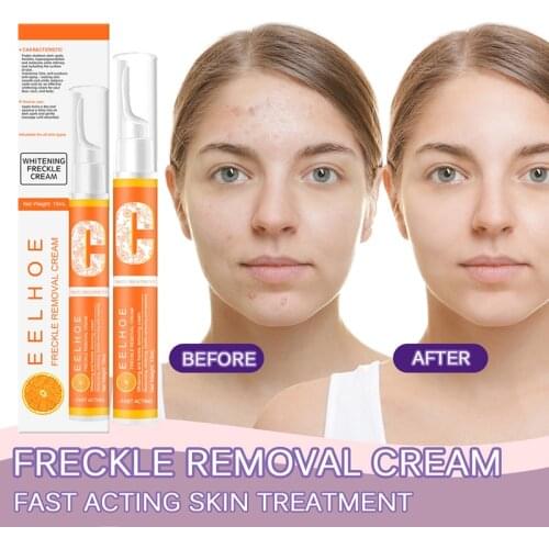 EELHOE Face Cream Vitamin VC Face Cream Remove Dark Spots Whitening Face Care Moisturizing Anti-Aging Firming Skin Care Cosmetic