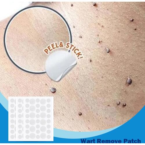 360/108/36pcs Skin Tag Remover Warts Remover Patch Wart Treatment Cream Herbal Extract Foot Corn Plaster Acne Warts Sticker