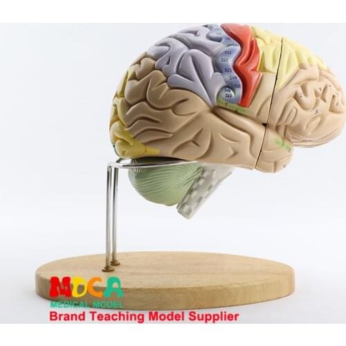 Two-fold Brain Assembly Brain Anatomy Human Brain Model Medical Teaching MDN002
