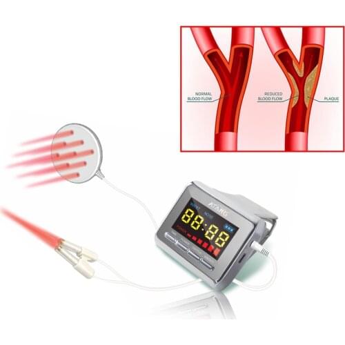Laser 650nm Diabetes Cholesterol Blood Sugar Diabetics New product arrival Acupuncture and moxibustion Technology Medical Laser