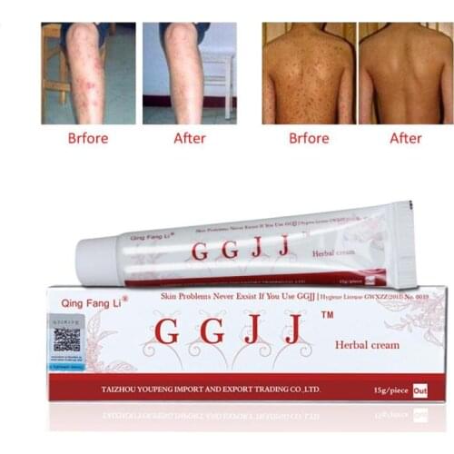 Psoriasis Cream Body Massage Patches Anti Eczeem Psoriasis Cream Works Perfect Relieve All Skin Problems For itching patch