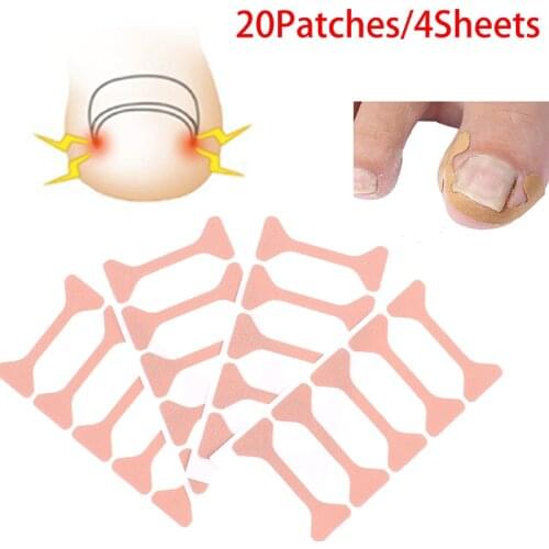 20Patches Ingrown Toenail Band Aid Relief Pain Paronychia Correction Pedicure Elastic Force Sticker Repair Bandage Toe Nail Care