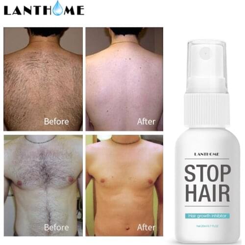 Prevents Hair Growth Inhibitor Spray after Hair Removal Use Whole Body Leg Body Armpit Facial Depilation Essence Liquid TSLM1