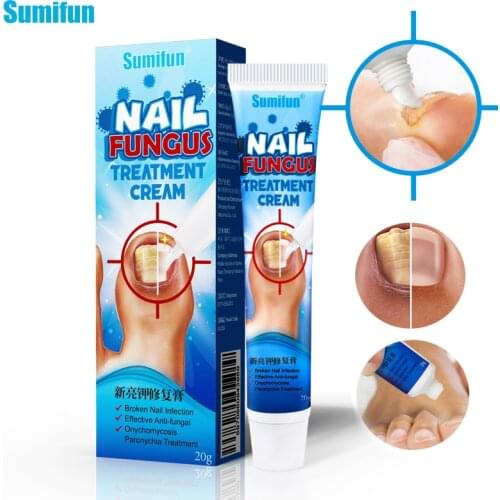 1Pcs 20g Nail Repair Ointment Paronychia Onychomycosis Treatment Cream Toe Foot Fungal Anti Infection Herbal Medical Plaster