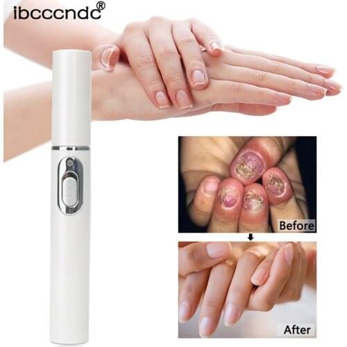 Toe Onychomycosis Paronychia Anti Fungal Fungus Care Repair Serum Kit Nail Art Nail Repair Onychomycosis