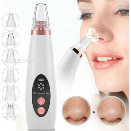 Black Dots Vacuum Pore Cleaner Nose Black Point Remover Blackhead Acne Pimple Removal Suction Extractor Facial Beauty Care Tools