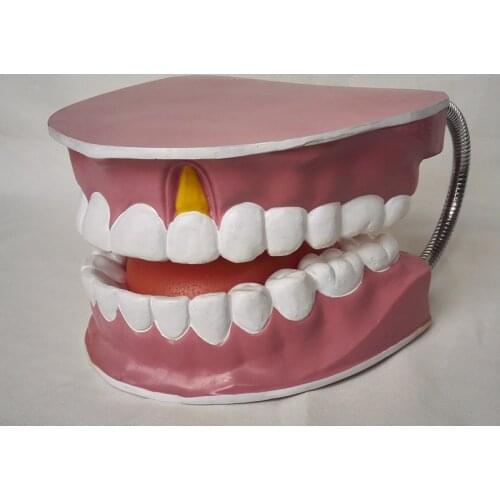 Oversized Tooth Care Health Model Dental Care Model Full Mouth Model with Tongue Teeth Anatomy Pathology Dentistry 20X24X12CM