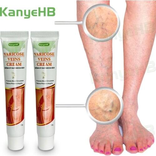 2pcs New Arrivals KanyeHB Varicose Vein Ointment Scrotum Varicocele Medical Cream Potent Treatment Feet Varicosity Cream A640