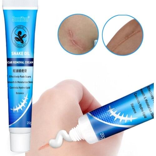20g Old Scars Eraser Cream Healing Remove Pregnancy Cream Burns Cuts Ointment Powerful Stretch Marks Skin Repair Removal P1177