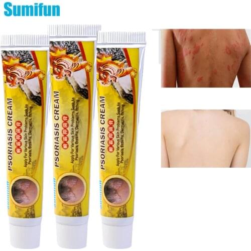 3 Pcs Sumifun Skin Psoriasis Cream Tiger Balm Dermatitis Eczematoid Eczema Ointment Treatment Psoriasis Plaster Skin Care No Box