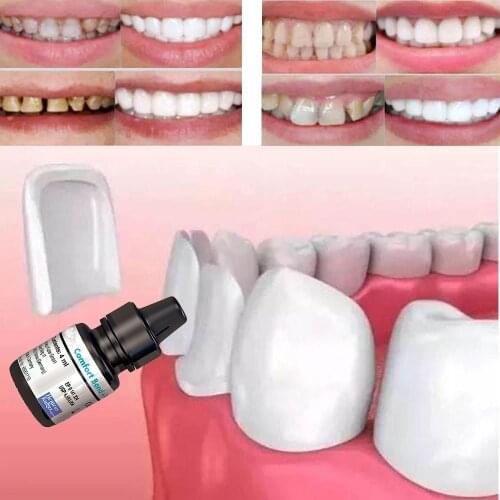 Tooth Veneer Quick Adhesive Dental Comfort Bond Desensitizer Equivalent Formula Bond Enhancer Teeth Whitening Products