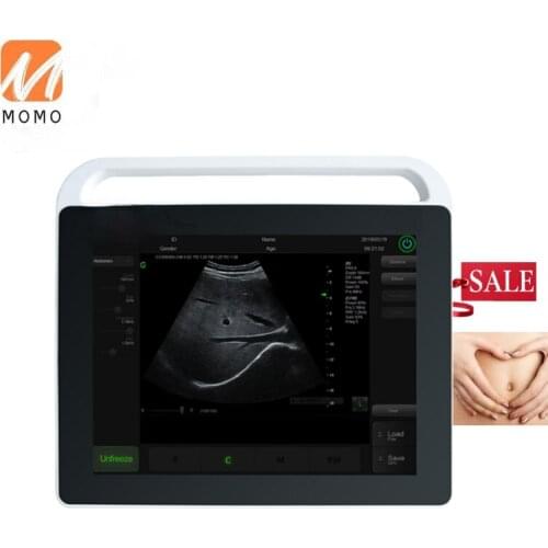HR1Computer type ultrasound with Keyboard and Mouse