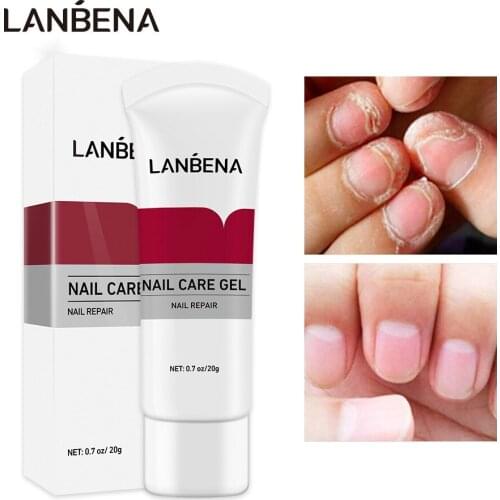 LANBENA Nail Care Gel Fungal Nail Treatment Remove Onychomycosis Nail Care Effective Against Nail