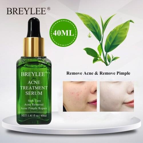 BREYLEE 40ml Acne Treatment Serum Spots Pimple Removal Blemish Spot Skin Care Essence Oil Control Whitening Smooth Skin Care New