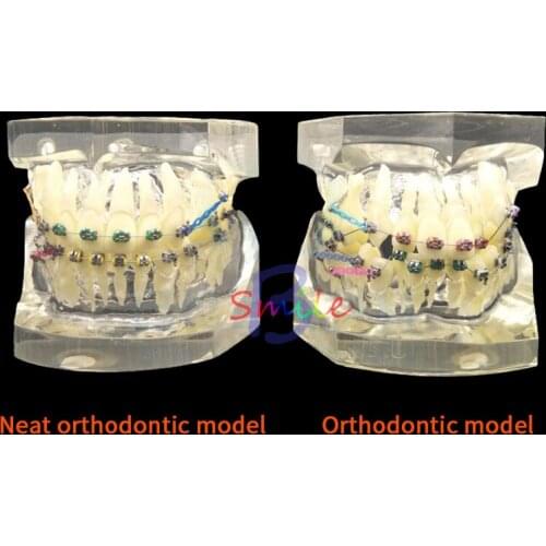 Dental Orthodontic Study Teaching Model Teeth Orthodontic With Colorful Brackets for Neat and misaligned models choose