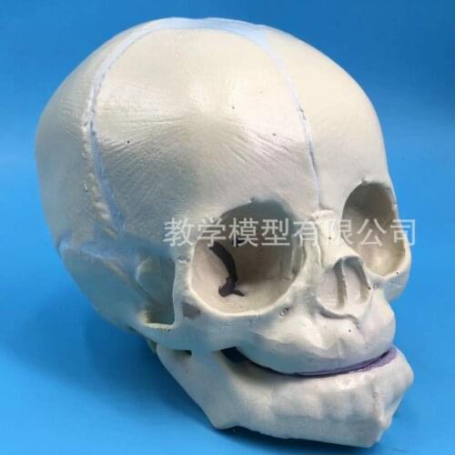 Morphological model of newborn Skull Fetal skull Infant skull model