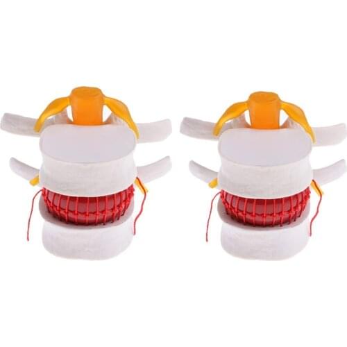 2pcs Human Lumbar Disc Vertebral Column Model Medical Anatomical Model for School Teaching Tool Learning Display Lab Supplies