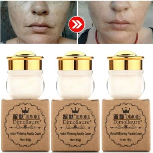 Dimollaure whitening Freckle cream Remova melasma Acne Scars pigment Melanin brown spots sun sopts Retinol cream face cream