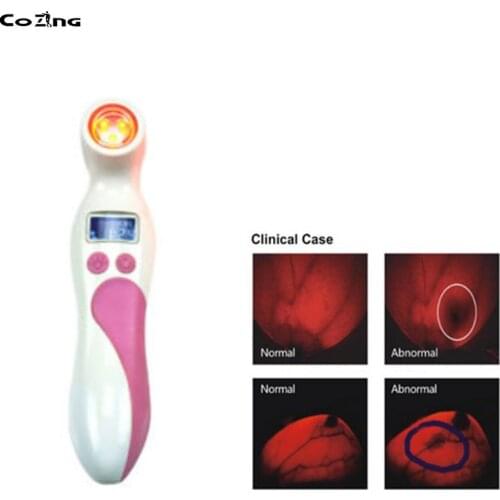Electro Laser Physiotherapy Equipment Portable Breast Cancer Analyzer Breast Lump Check Detector Women Home Use