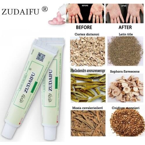 Zudaifu Psoriasis Cream Body Skin Care Dermatitis Eczematoid Eczema Pruritus Ointment Treatment