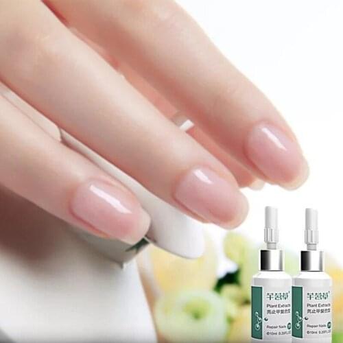 2 Pcs Nails Repair Liquid Set Plant Extract Antibacterial Onychomycosis Treatment Nail Care MA