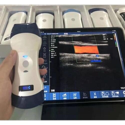 128 elements PW color wireless veterinary ultrasound convex and linear probe double head animal pregnancy