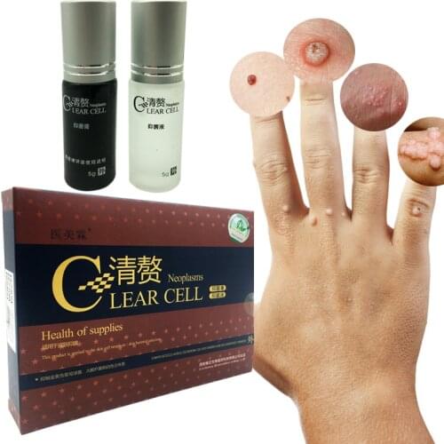 Herbal Ointment Antibacterial Skin Tags Liquid Treatment Psoriasis Rash Urticaria Desquamation Cream Removal Skin Tag Care