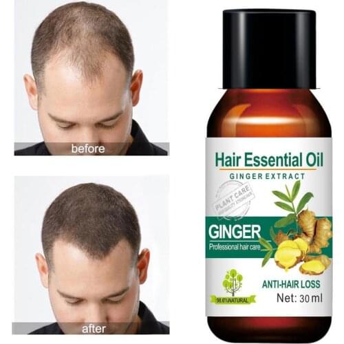 MOKERU Ginger Organic Herbal Hair Essential Oil Treatment Hair Loss Fast Hair Growth Essence Hair Loss Products 30ml
