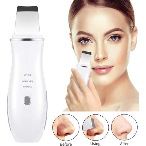 Ultrasonic Skin Scrubber Peeling Shovel Ion Acne Blackhead Remover Spatula Deep Face Cleaning Machine Facial Lifting Massager
