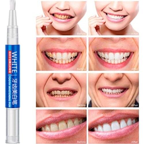 3Pcs Peroxide Gel White Teeth Whitening Pen Tooth Gel Whitener Bleach Remove Stains Oral Hygiene Tooth Cleaning Bleaching Kit