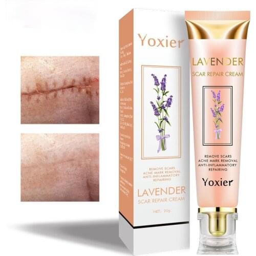 Lavender Scar Repair Cream Repairing Removing Burn Scars Promote Cell Regeneration Enhance Elasticity Cucumber Skin Care 20g